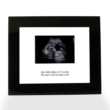 Personalised Print - Baby Scan Photo Upload
