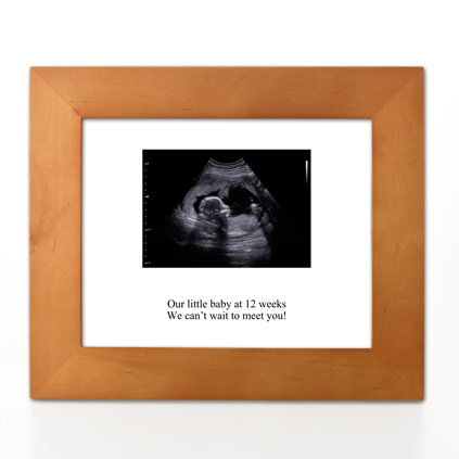 Personalised Print - Baby Scan Photo Upload