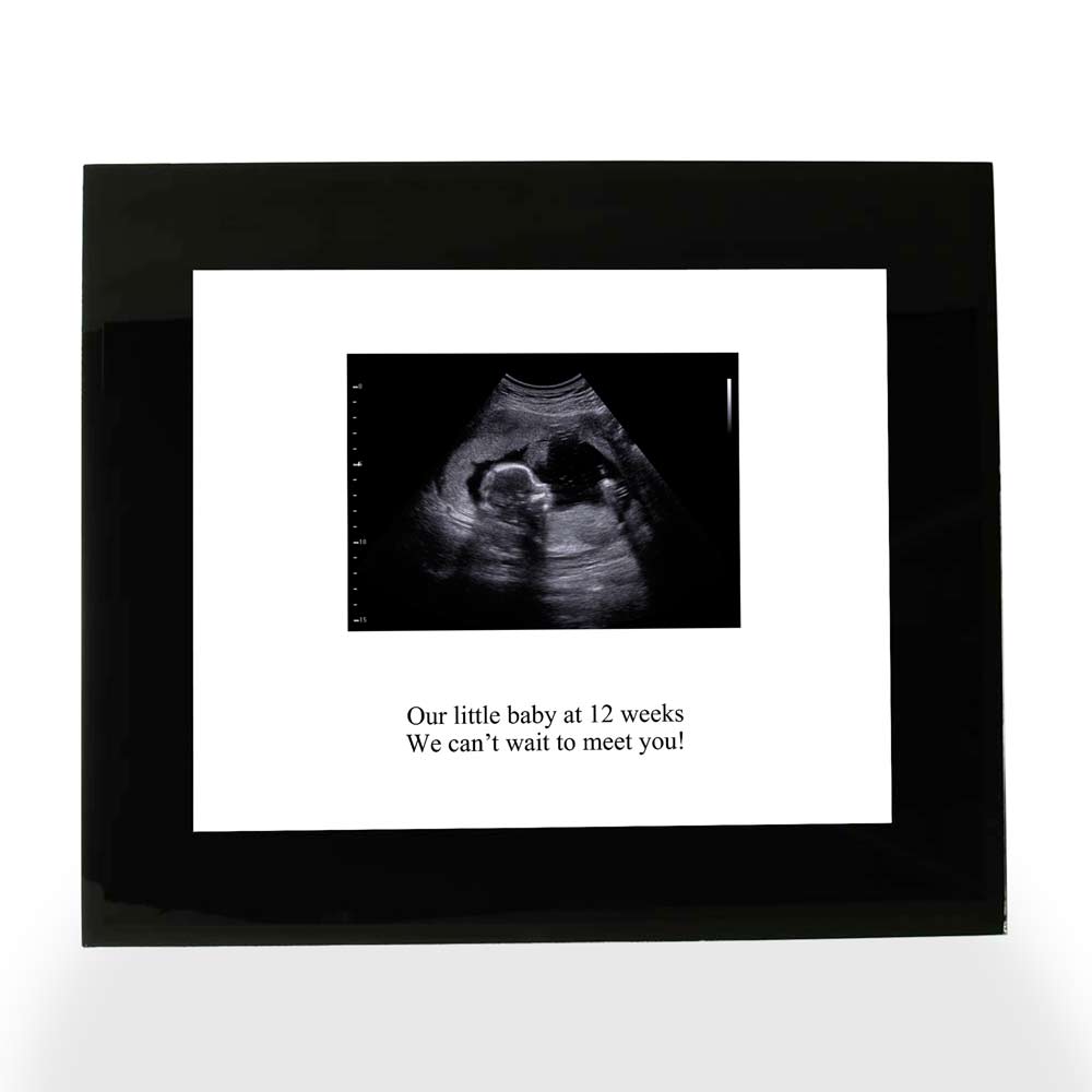 Personalised Print - Baby Scan Photo Upload - Click Image to Close
