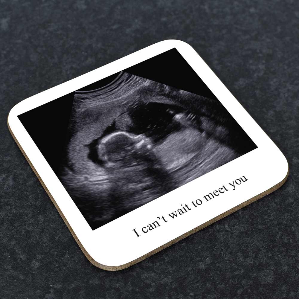Personalised Coaster - Baby Scan Polaroid Photo Upload - Click Image to Close