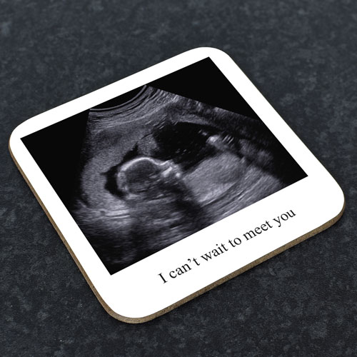 Personalised Coaster - Baby Scan Polaroid Photo Upload